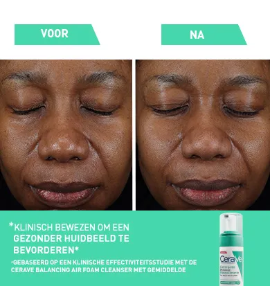 glycolysine